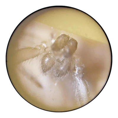 Microscope sample view 1